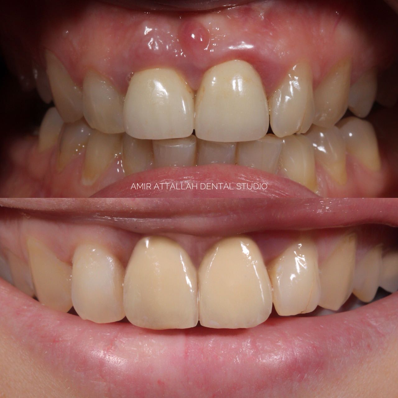 Before treatment — external documented example