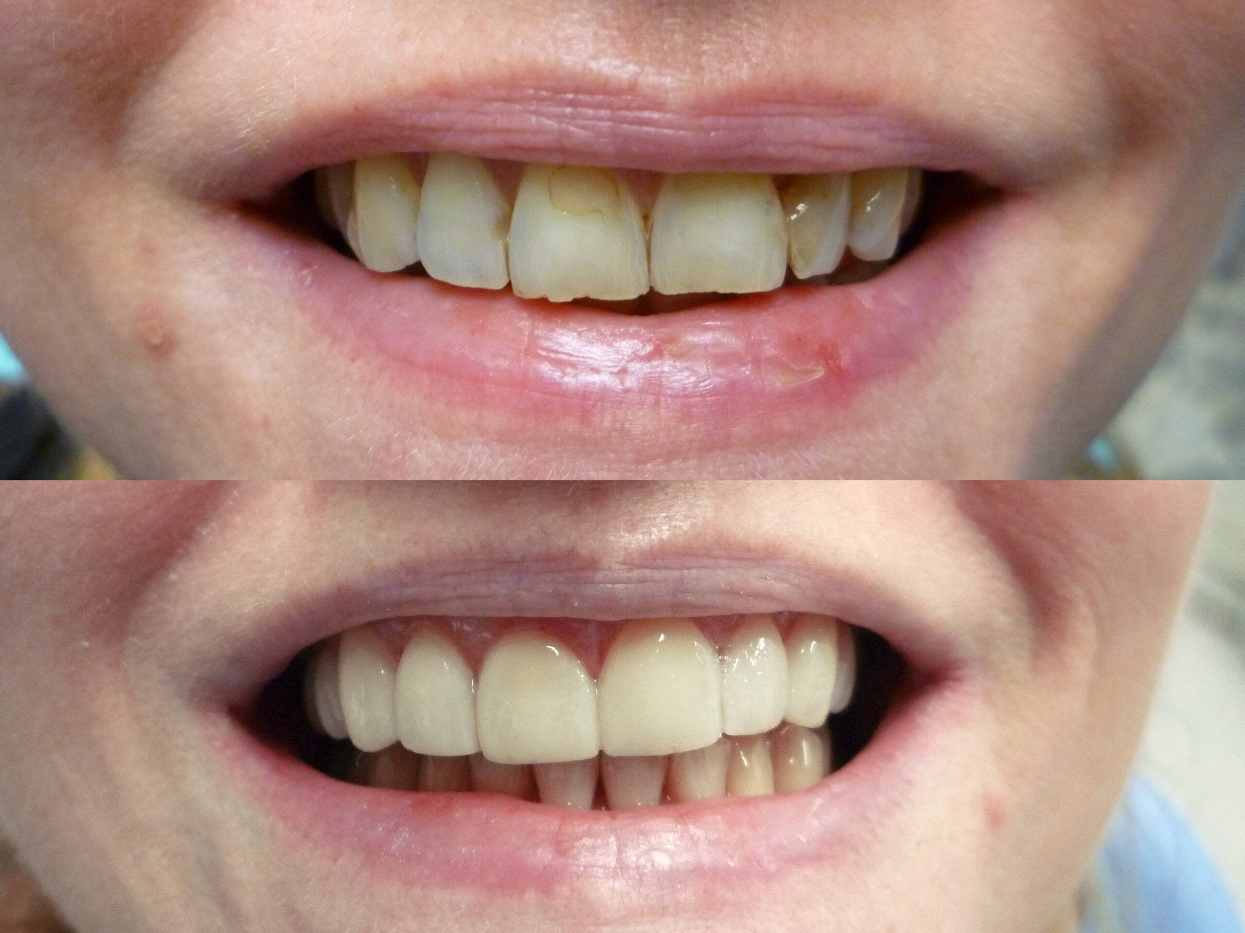 Before treatment — external documented example